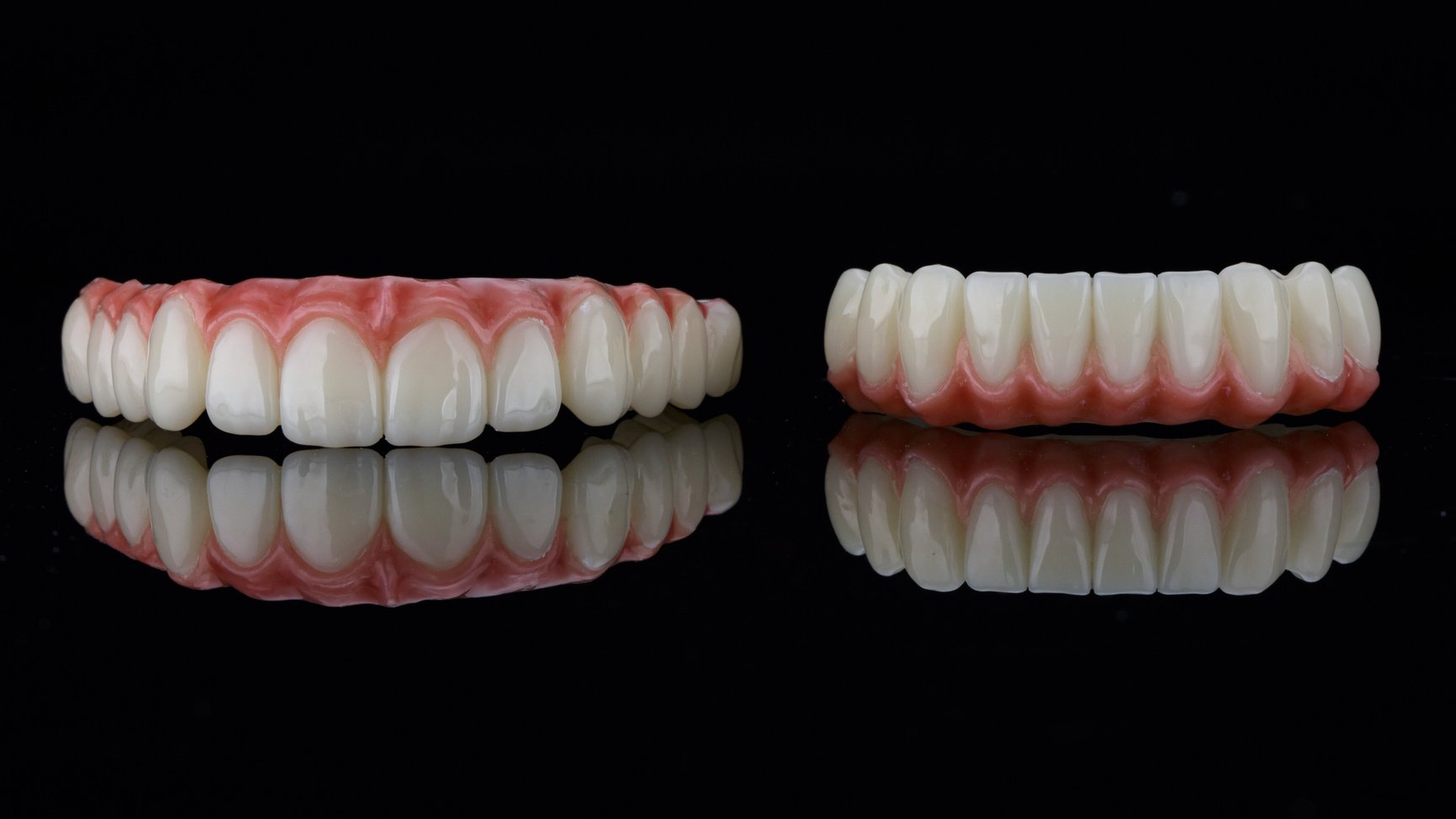 excellent angle on dental prostheses with the gums of the upper