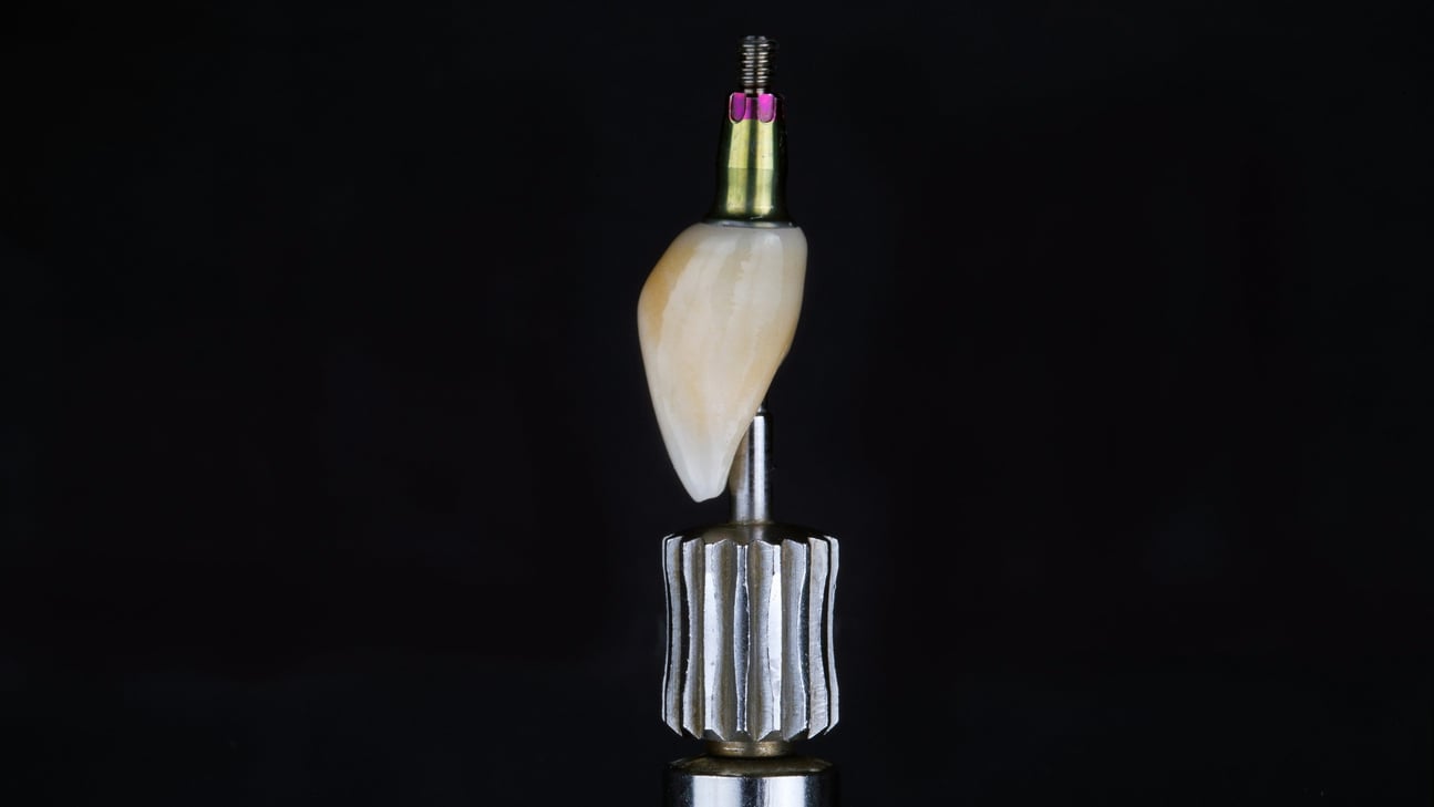 ceramic dental crown of the central tooth on a screwdriver with