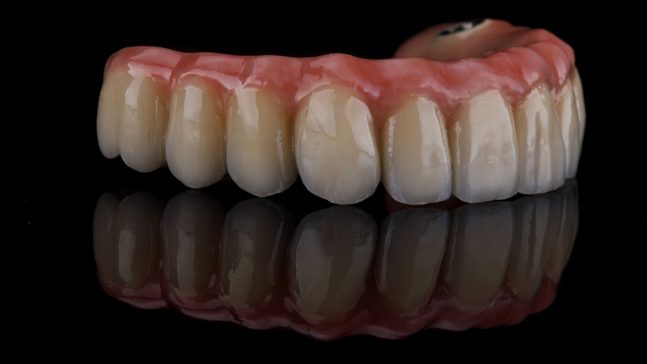 macro photo of a dental prosthesis of the upper jaw on a bla